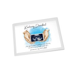 Ramka z USG – Wyjątkowy Sposób na Ogłoszenie Ciąży... 2